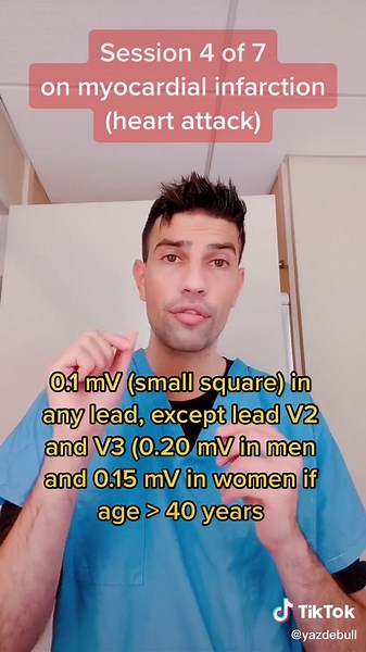 Understanding ECG Changes in Myocardial Infarction