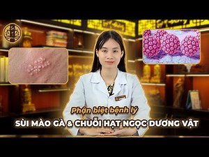 SÙI MÀO GÀ & CHUỖI HẠT NGỌC DƯƠNG VẬT - Phân biệt bệnh lý | TUỆ Y ĐƯỜNG