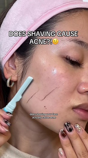 Shaving with Acne: Tips for Glowing Skin