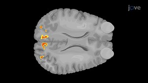 Video: Blood Oxygen Level-Dependent Functional Magnetic Resonance Imaging of the Visual Cortex - Experiment