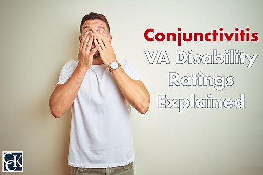 Conjunctivitis VA Disability Ratings Explained | CCK Law