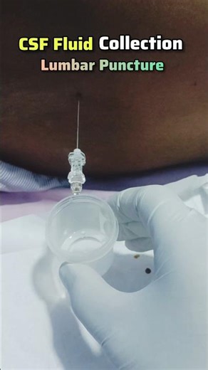 Lumbar Puncture / CSF Analysis #hospital #shorts #doctor #aestheic