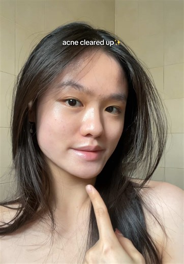 Cutting Sugar for a Slimmer Face: My Transformation