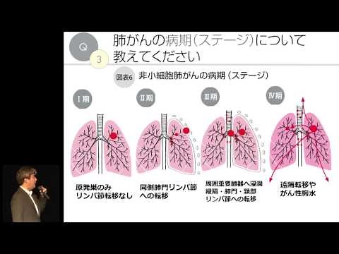 Overview of Lung Cancer Kazuyoshi Fujitaka