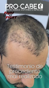 3K views · 106 reactions | “World Hair Transplant Repair Day” as part...