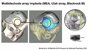 VIDEO: Integrating Single Neurons and Circuits in Stem Cell Derived Neuronal Networks: A Systems Neuroscience Perspective with Julio Martinez-Trujillo - Breaking News in Stem Cells