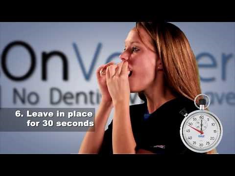 New How to Take Dental Impressions 2017 Brighter Image Lab