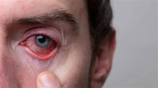 10 hidden health risks your eyes reveal before symptoms appear: Early signs you might be overlooking and prevention tips