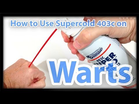 How to Use Supercold 403c Freeze Spray on Warts, Skin Tags, Moles or Freckles?