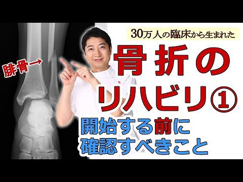 [Fibular fracture] Important points to check before starting treatment. Checklist before rehabili...