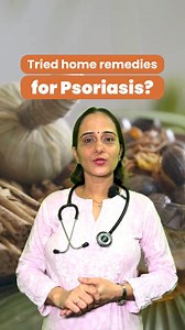 48K views · 128 reactions | Tired of flare-ups? Try Ayuderme, a trusted Ayurvedic formula that heals, detoxifies & restores your skin — with zero side effects. ✅ 5L+ Happy Users ✅ Clears Skin from Within ✅ Pure, Natural & Safe Feel the difference — the Ayurvedic way.  | Welex Care | Facebook