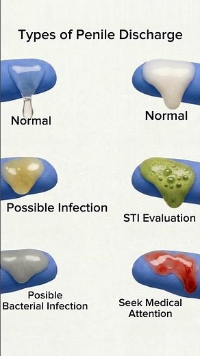 What Different Penile Discharge Colors Can Mean #sti #peniledischarge