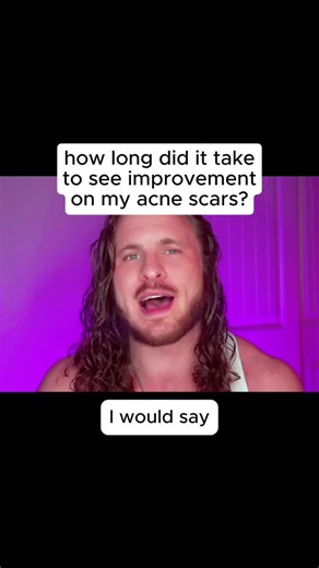 11 reactions | Acne scars is one of the hardest skin conditions to treat! Here's how long it took @teamacne to see results Routine: Microneedling once every 1 or two weeks with serum afterwards Pumpkin Enzyme Masque once weekly Vitamin c creme moisturizer daily Products used: Banish Starter Kit: https://banish.com/products/all-banish-products-1 Backed with 45 day money back guarantee, order now to get a $30 giftcard | Banish Acne Scars | Facebook