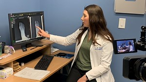 Less invasive bunion surgery brings relief to some patients