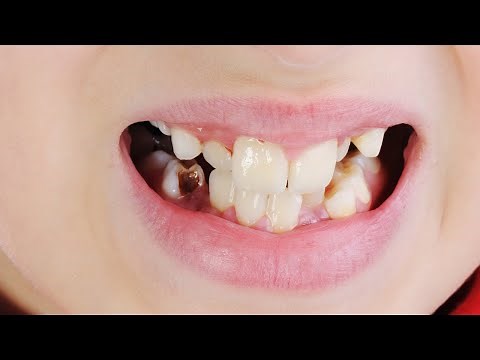 The Connection between Heart Disease and Oral Health | Health Matters | KSPS PBS