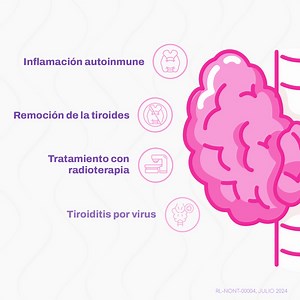312 reactions · 67 shares | Conocer las causas del hipotiroidismo es...
