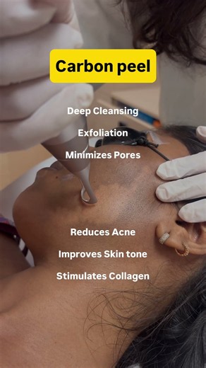 Hollywood Peel Explained | The Secret to Clearer, Smoother & Glowing Skin | Venkat Center #shorts