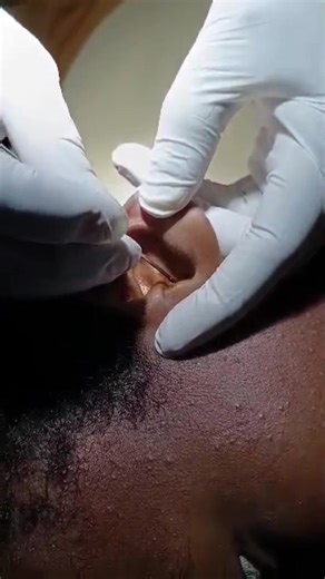 Daaweyn Iyo Daryeel Caafimad Ee Saacid Eye And Ear Center