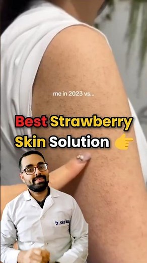 🌟 How to Treat Strawberry Skin (Keratosis Pilaris) 🌟 #strawberryskin #KeratosisPilaris #kp