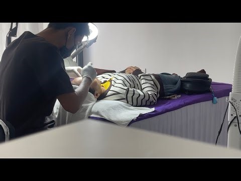 Acne Extraction for a Regular Client with Acne-Prone Skin-Breakouts Appear Quickly