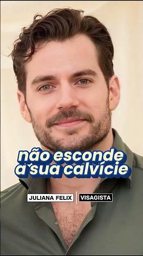 Tipo M: a calvície do homem mais bonito do mundo #hairline #análise