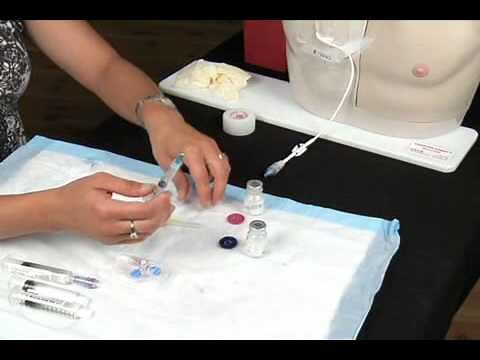 Chapter 17 - Declotting Catheter