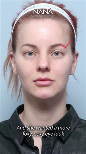 How I accidentally took 10 Years Off My Face #facelift