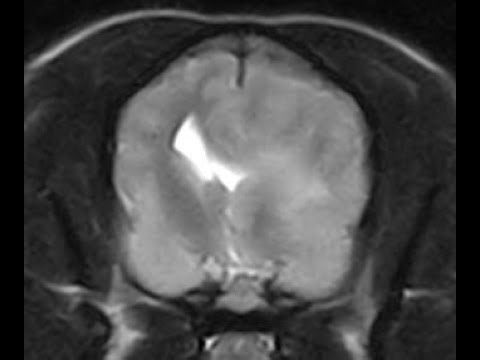 Approach to MRI Interpretation - Pattern Recognition and Case Examples