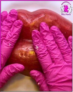 10K views · 24 reactions | Big lip pimple pop: Satisfying and strangely calming! | MissFlores | Facebook