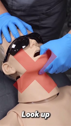 This simple technique helps stop bleeding faster and keeps airways clear. #medical #aivideo