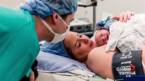 Pilot program gives C-section babies skin-to-skin contact with moms