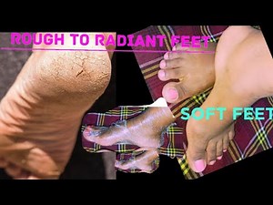 THE SECRET TO SUPER SOFT FEET : Baking soda ,Soak and scrub FOOT SPA AT HOME #skincare#diy#trending