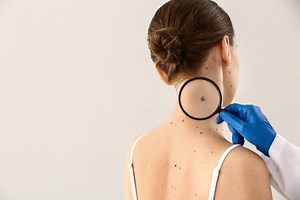 Recognizing 5 Serious Skin Conditions That Need Immediate Care