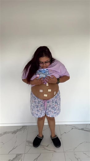 Humorous Moments in Gastric Sleeve Recovery
