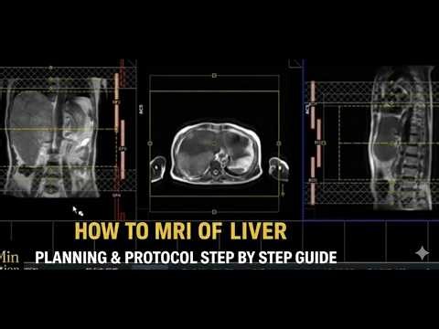 How to Perform MRI Triphase Liver | Step-by-Step Positioning & Sequences