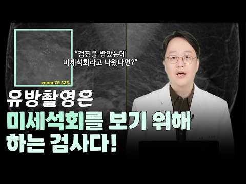 Microcalcification is examined by tissue biopsy using a mammotome