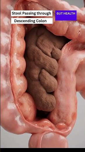 Stool passing through descending colon