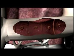 Medications - Symbicort Smart