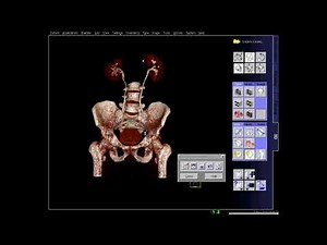 ct urogram (SIEMENS) in syngo acquisition workplace..