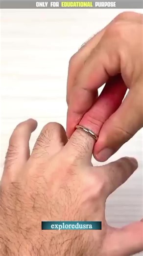 How to Remove Stuck Ring