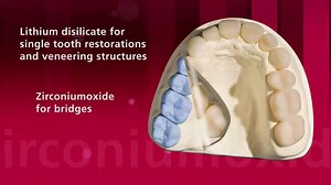 High-strength zirconium oxide (ZrO2) really proves its worth in...