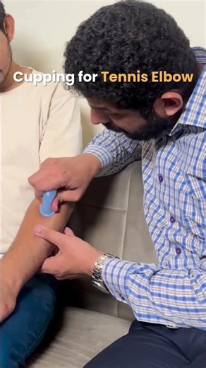 Cupping Therapy: Natural Relief for Tennis Elbow