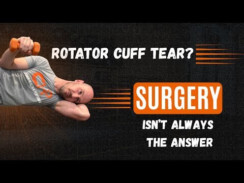 Rotator Cuff Tear? Why Surgery Isn’t Always the Answer