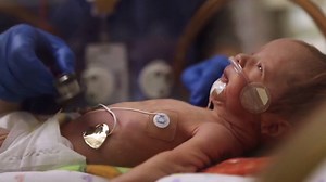 23K views · 492 reactions | Advances in fetal medicine now allow us to successfully treat many congenital diseases and other high-risk conditions before a baby is even born. Dr. Brad Feltis, pediatric surgeon at Midwest Fetal Care Center, discusses advantages of the new open fetal surgery program and how it’s bridging gaps in the Minneapolis community. | Children's Minnesota | Facebook