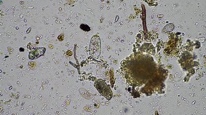 clip-1093187857-soil-microbes-organisms-compost-sample-fungus-fungi