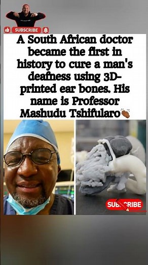 History Made in Medicine A Breakthrough That Restores Hearing 👂🏽✨#shortvideo #menieres #cochlea#news