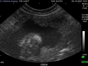 We are so excited that our sloth Lightning is pregnant with her first baby! Dr. Wojtusik from our Center for Conservation and Research of Endangered Wildlife (CREW) has been able to perform ultrasounds to monitor the cubs development. This image shows the ribcage and spine quite clearly. | Cincinnati Zoo & Botanical Garden