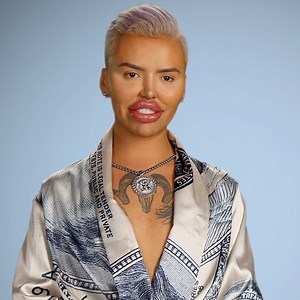 The Botched Docs Face an Amputation and More Shocking Cases in Grisly Season 8 Trailer