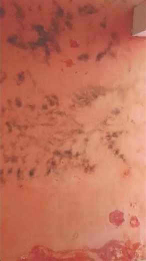 tre iosions from natural government'ns