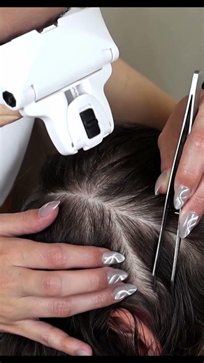 ASMR Removing LICE from Her Scalp | School Nurse Lice Check with Tweezers and Nails #shorts #asmr